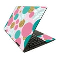 thumbnail image 1 of Skin Decal Wrap Compatible With HP Envy x360 15" (2020) Sticker Design Golden Bubbles, 1 of 4