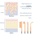thumbnail image 3 of Máquina facial de alta frecuencia - TUMAKOU Máquina portátil de varita para la piel facial de alta frecuencia con 4 tubos diferentes, 3 of 5