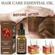 thumbnail image 4 of Natural Hair Growth Serum, Strengthens Roots, Minimizes Shedding, Enhances Volume & Vitality, 4 of 5