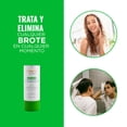 thumbnail image 4 of Gel Antiacné Antiimperfecciones con Ozono 30 g, 4 of 7