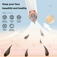 thumbnail image 3 of Blackhead Remover Pore Vacuum, Visible Facial Pore Ceaner, Skin Care Tool for Acne Pimples with Magnification, Blackhead Extractor, Used for Extraction of Acne and Blackhead, 3 of 5