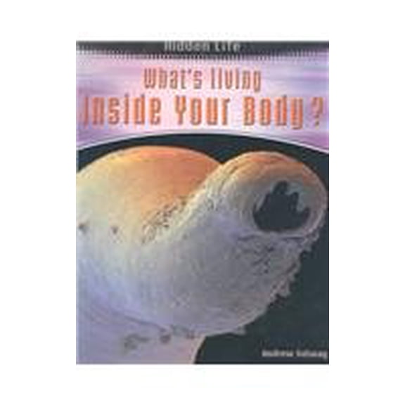 Pre-Owned Whats Living Inside Your Body? Hidden Life Paperback Andrew Solway