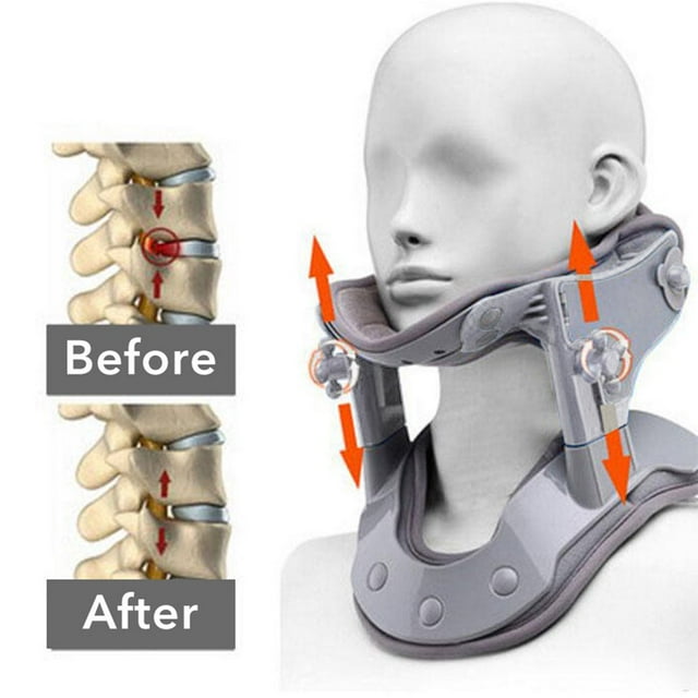 Cervical Traction Device Adjustable Ergonomic Heat Treatment Electric Comfortable Pain Relief Portable Heating Neck Tractor Stretcher Posture Corrector for Home