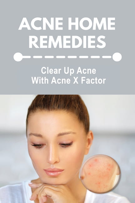 Clear natural skin for remedies How to
