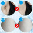 thumbnail image 4 of Freezing Point Laser Epilator Armpit Hair, Leg Hair, Lip Hair, Private Parts Epilator, 4 of 5