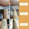 thumbnail image 4 of Tattoo Cover-Up Stickers - Scar Concealer - Skin Cover-Up Patches, 4 of 9
