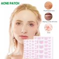 thumbnail image 2 of Waterproof Acne Pimple Patches Hydrocolloid Sticker Pimples Removal Facial Car; A6Q2, 2 of 8