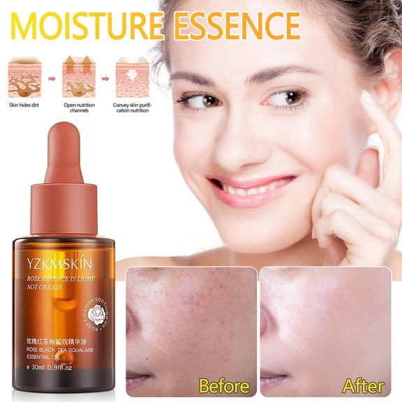 Gzwccvsn Rose Black Tea Squalane Essence Oil Hydrating Moisturizing Moisturizing Essence Liquid Facial Care 30ml face, body skincare korean