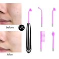 thumbnail image 2 of High Frequency Facial Wand With 4 Argon For Anti-wrinkle Black Purple Light, 2 of 5