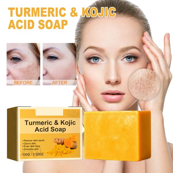 Organic Turmeric Soap for Dark Spots & Acne, Turmeric Soap for Skin Brightening and Clearing Formula, All Natural Turmeric Soap Bar