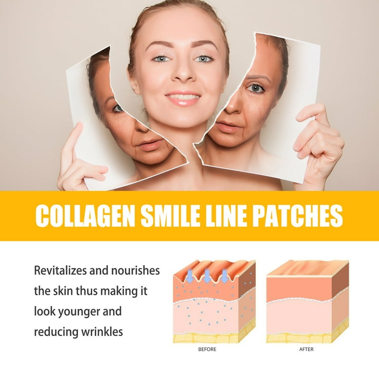 Lomubue 10Pcs/Box Smile Line Patches Non-irritating Effective Firm Skin  Reduce Wrinkle Collagen Smile Line Patches for Skin-care