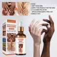 thumbnail image 4 of Suero blanqueador de nudillos oscuros, mano, codo, rodilla, suero iluminador, hidratante para la piel, 50ml, 4 of 5