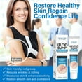 thumbnail image 3 of Keloid Bump Removal Gel. Silicone Scar Treatment - Professional Scar Cream for Old & New Scars - 20ml, 3 of 7