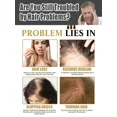 thumbnail image 4 of Loción de masaje para el cabello para hombres y mujeres, 2024 potente, 4 of 5