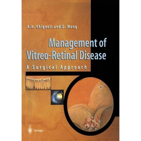 Management of Vitreo-Retinal Disease : A Surgical (Best Vitreo Retinal Surgeon In India)
