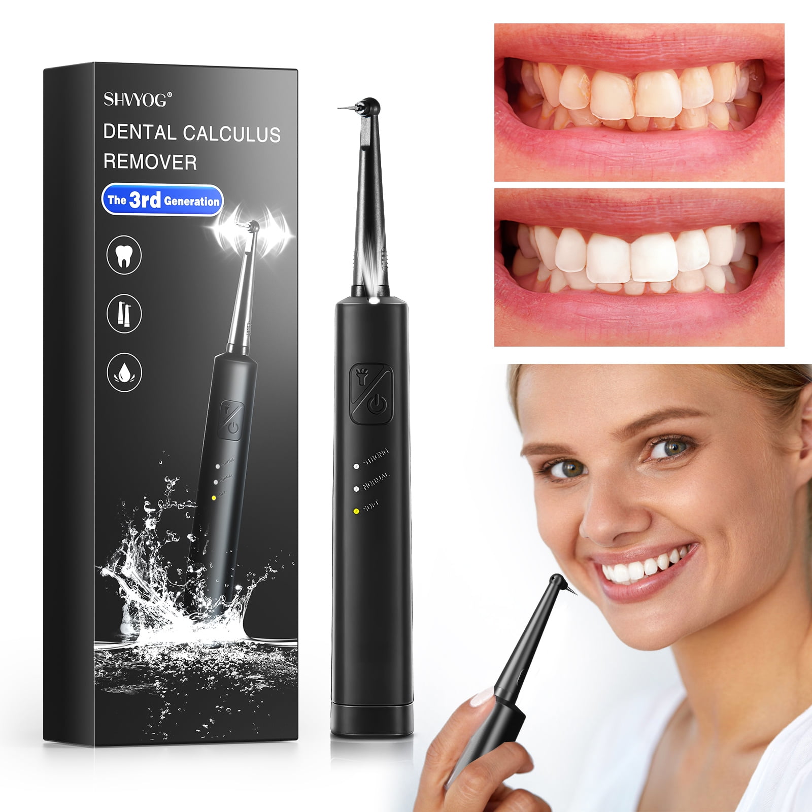 SHVYOG Electric Plaque Remover for Teeth, Ultrasonic Tooth Cleaner