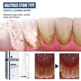 thumbnail image 3 of Tartar dissolving oral spray lasting fragrance dissolves tartar and bad breath, 3 of 5