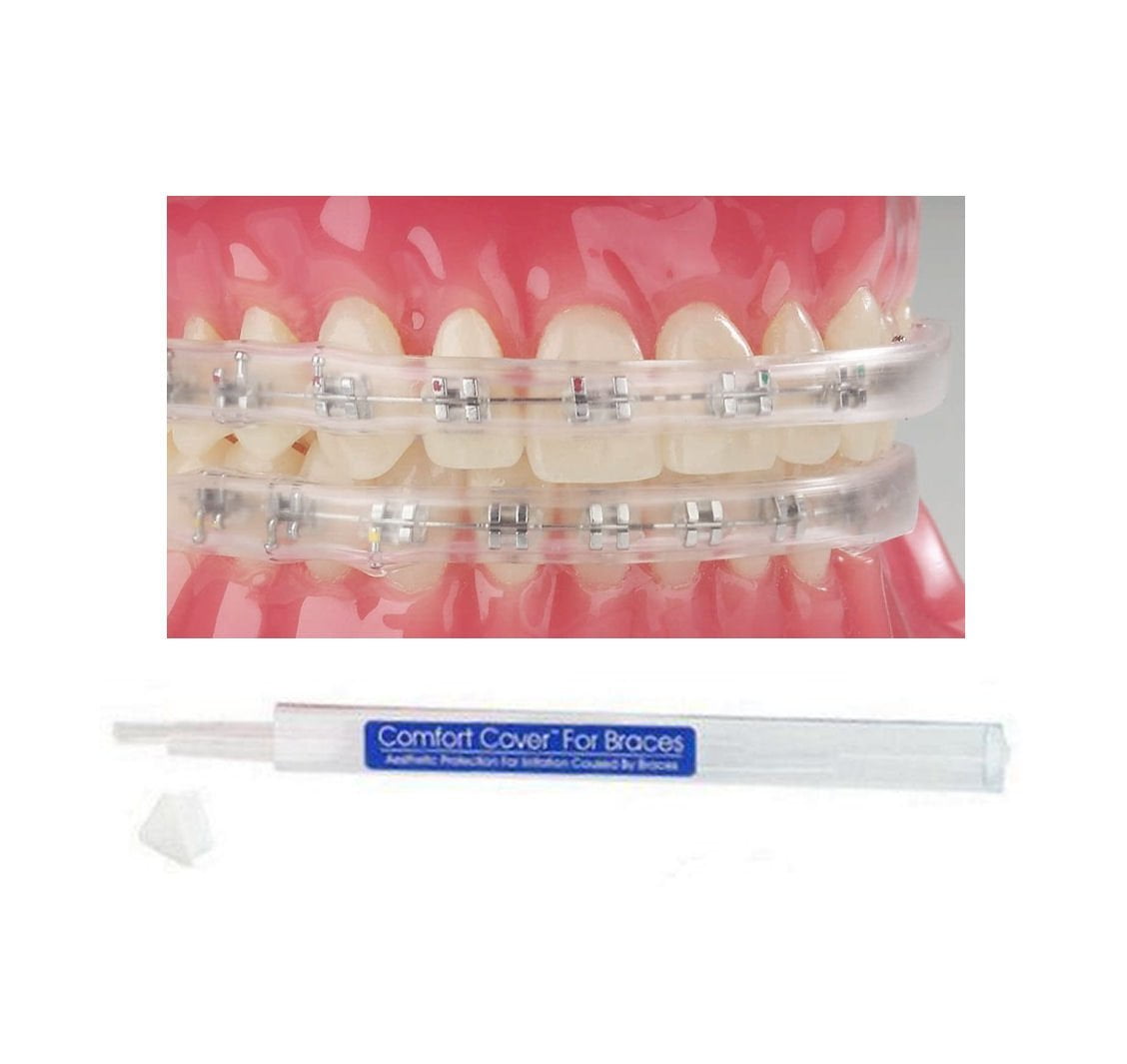 Comfort Lip Shield Night Teeth Protector Mouth Guard for Braces Orthodontic Dental