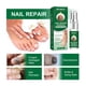 thumbnail image 5 of Esencia de tratamiento de hongos en las uñas Esencia de tratamiento de uñas para la eliminación profesional de hongos Likrtyny Cuidado Belleza, 5 of 9