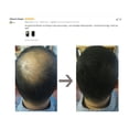 thumbnail image 5 of Fibras capilares de queratina para peinado y pérdida de cabello, polvos de color, engrosamiento del cabello, fibra capilar, tinte en polvo, SEVICH 25 g, marca privada OEM, 5 of 5
