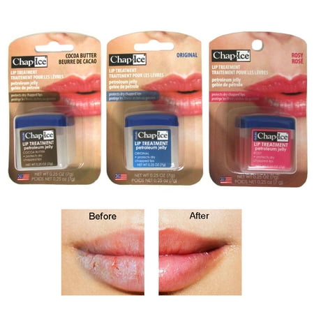3 Pc Chap Ice Lip Treatment Therapy Balm 0.25 Oz Flavors Petroleum Jelly