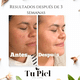 thumbnail image 3 of Nayaaguie Crema para manchas con Hidroquinona, despigmentante y aclarante. Manchas de sol, paño y hormonales. Tu Piel Dra. Lietza, 3 of 7