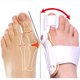 thumbnail image 2 of 1 pieza de férula para enderezar el juanete del dedo gordo del pie, corrector, separador de dedos, protector de dedos, alivio del hallux valgus, ambos pies izquierdo y derecho, usado, 2 of 6