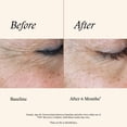 thumbnail image 4 of SkinMedica TNS Recovery Complex para el cuidado de la piel, 30 ml, 4 of 9