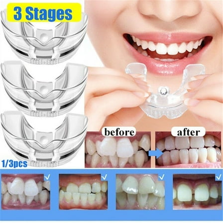 Dental Braces Tooth Retainer Straighten 1 2 3 Stage Orthodontic Teeth Corrector
