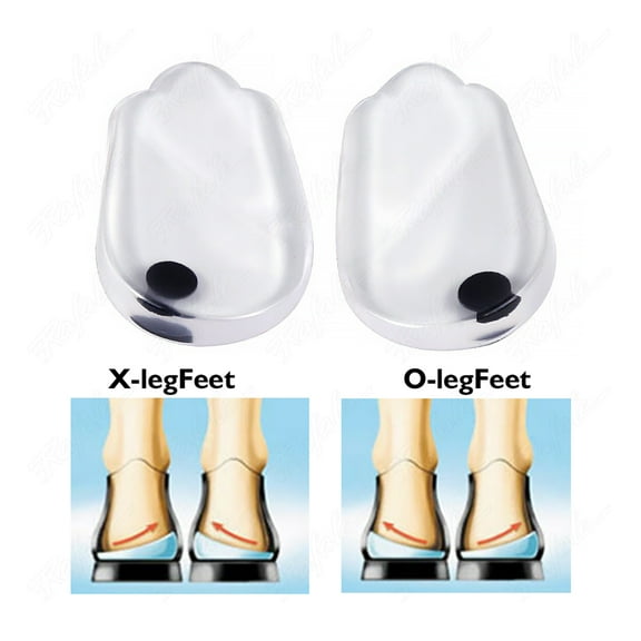 3 Pairs Magnets Silicon Orthopedic Insoles Foot Care Tool For Men Women Health Care O/X Type Legs Knee Varus Correction Heel Pads