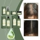 thumbnail image 3 of Aceite capilar de romero para el crecimiento del cabello | Sérum Tratamiento Nutritivo del Cuero Cabelludo con Menta | Hidrata, reduce la caspa, alivia la picazón del cuero cabelludo, mejora la, 3 of 7