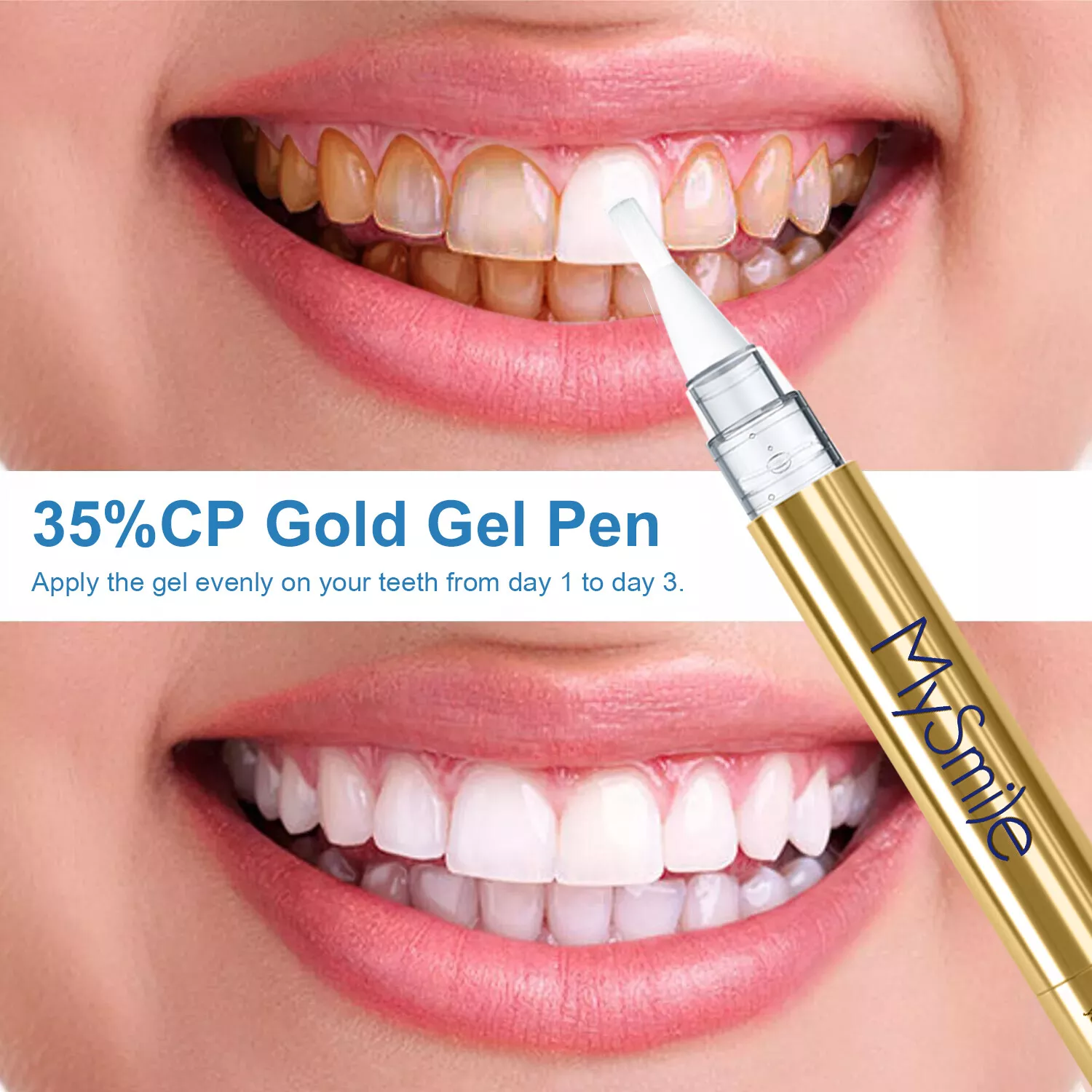MySmile Deluxe Teeth Whitening Kit with Pens photo 5