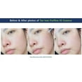 thumbnail image 3 of Sérum facial Dr. Ceuracle de leegeehaam Tea Tree Purifine 50 ml, 3 of 9