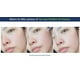 thumbnail image 3 of Sérum facial Dr. Ceuracle de leegeehaam Tea Tree Purifine 50 ml, 3 of 9