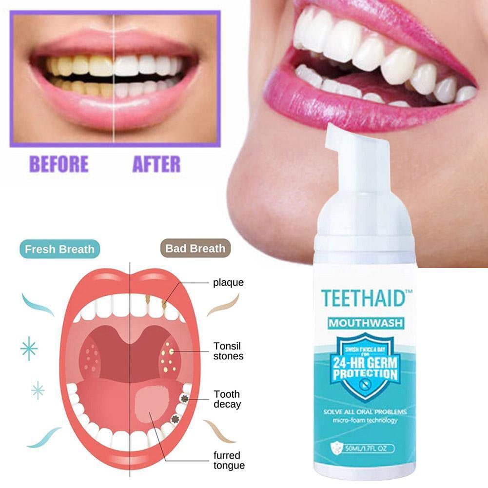 Teethaid Foam Mouthwash, Teeth Brightening Mouth Wash, Preventing and Healing Caries