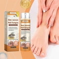 thumbnail image 2 of Bee Venom Nail Repair Serum, Nail Care Solution, Natural Bee Venom Nail Care Spray, Ingrown Toenail Care Spray, 2 of 5