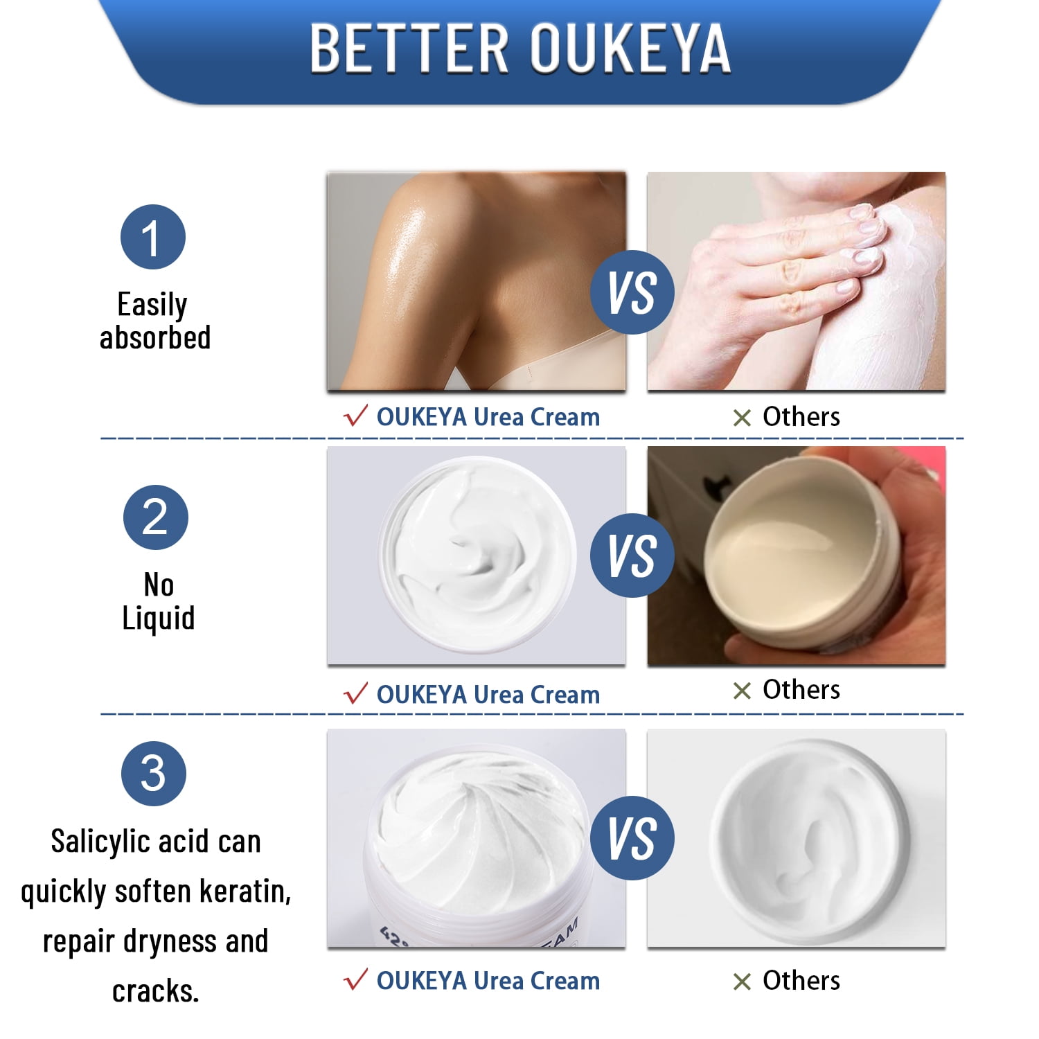 OUKEYA Urea & Salicylic Acid Cream For Dry & Cracked Skin Care, 42% Urea + 2% Salicylic Acid, 5.29 oz 4 Pack
