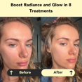thumbnail image 2 of Mascarilla de Arcilla Facial Glorio GLOW - Set de 8 Semanas con Vitamina C, 2 of 5