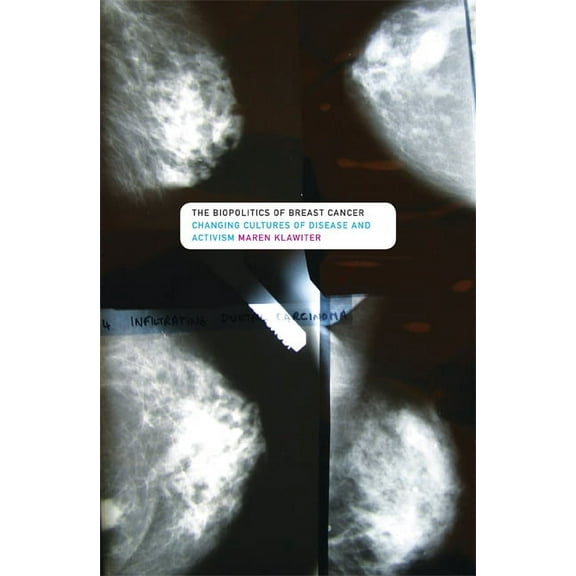 The Biopolitics of Breast Cancer : Changing Cultures of Disease and Activism (Paperback)