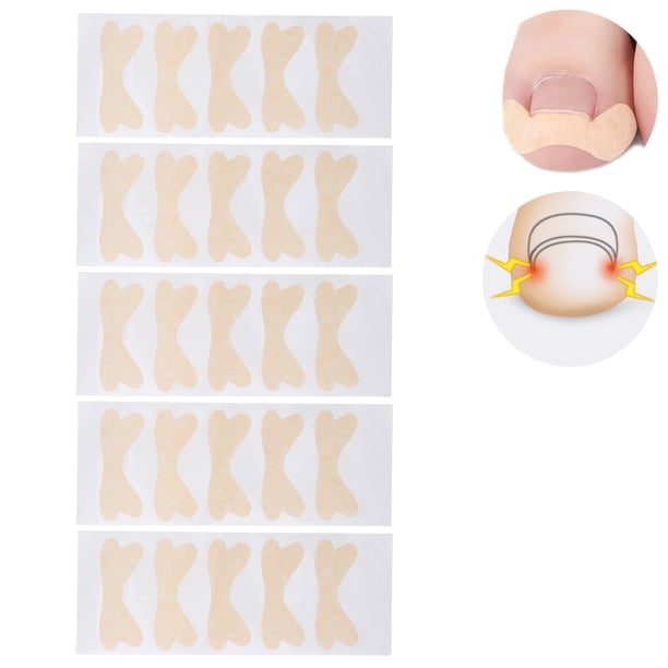 Parche Corrector De Uñas Encarnadas, Parche Corrector De Uñas Fácil De Usar Que Se Pega Firmemente En Tela No Tejida Para Hombre Para Viajes Para Mujer