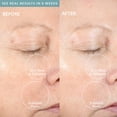 thumbnail image 4 of Dispositivo de limpieza facial PMD Beauty Clean Pro Plata, 4 of 9