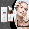 thumbnail image 4 of Fiudx Esencia de Caracol, Suero Hidratante Antiedad, Aceite Reparador de Líneas de Expresión, Elixir Iluminador, Tratamiento de Nutrición Profunda, Apto para Todo Tipo de Piel, Aplicación con Gotero., 4 of 6