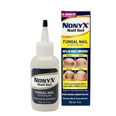 NONYX Fungal Nail Clarifying Gel, a Toenail Fungus Treatment That Cleans Out Keratin Debris Where Nail Fungus Thrives - 90% of Nails Improve, 4 fl oz