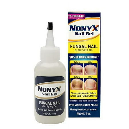NONYX Fungal Nail Clarifying Gel, Clears Out Keratin Debris Where Nail Fungus Thrives, 4 oz. Pack of 1