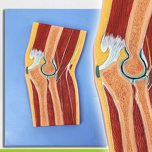 Wellden Medical Anatomical Elbow Joint Section Model