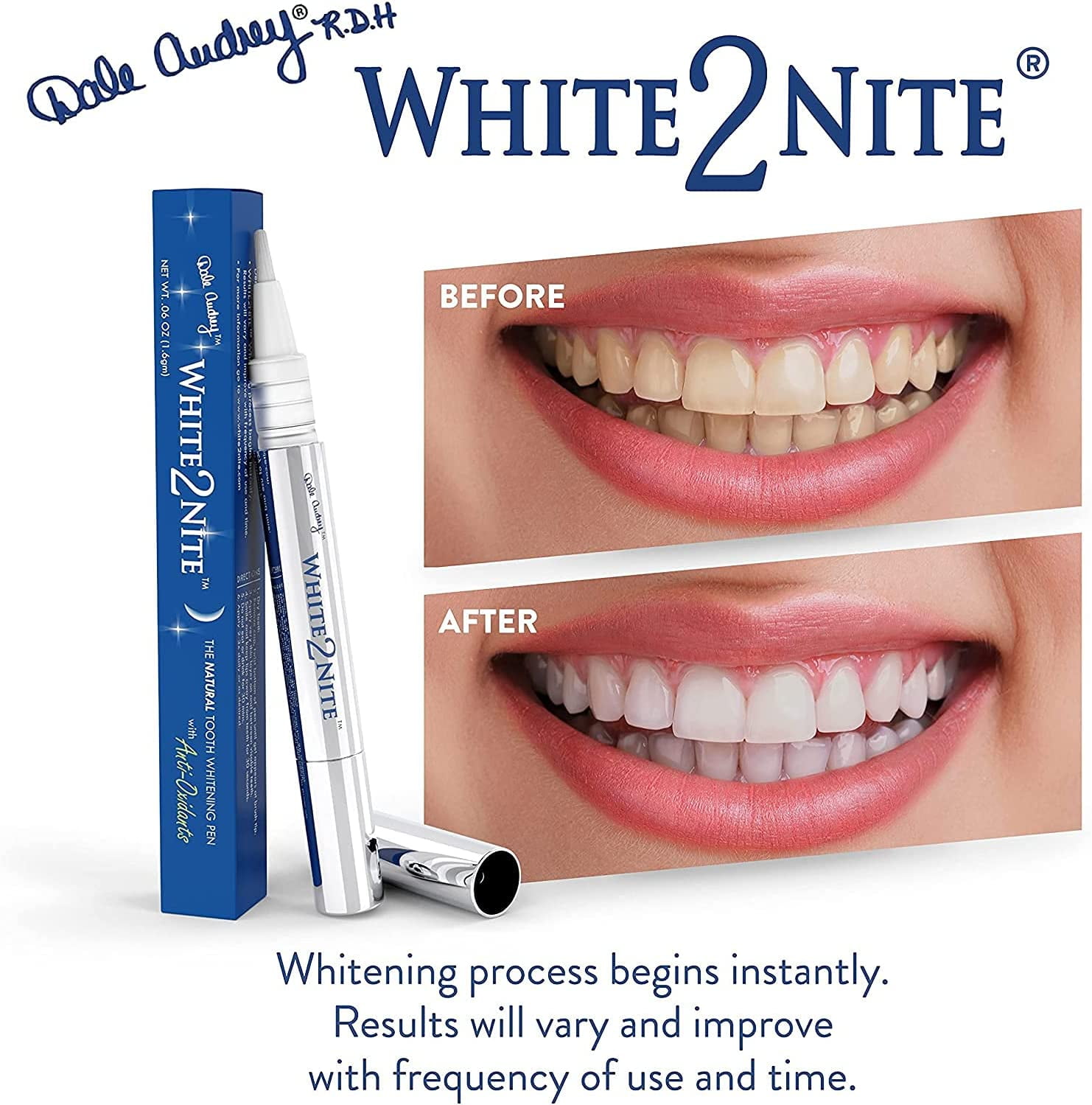 Dale Audrey White2Nite Tooth Whitening Pen