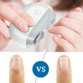 thumbnail image 7 of Smart Electric Nail Clipper for Elderly and Kids, Automatic Nail Trimmer with 3-in-1 Function, USB Rechargeable, Hands-Free Nail Care, 1* Electric Nail Clippers, 7 of 7