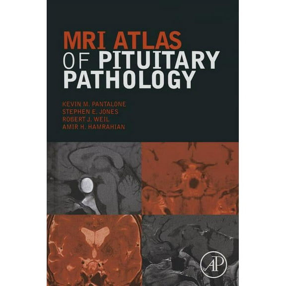 MRI Atlas of Pituitary Pathology, (Hardcover)