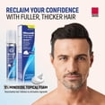 thumbnail image 5 of (2 pack) Taro Minoxidil Topical Aerosol Foam, 5%, Hair Regrowth Treatment for Men, 2.11 oz, 5 of 9
