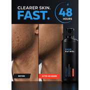 Bump Patrol Maximum Strength Aftershave Treatment Serum – Razor Bump Stopper and Ingrown Hair Treatment for Men and Women, Fast Acting Salicylic Acid for Razor Burn & Shaving Irritation - 4 oz Pack 1